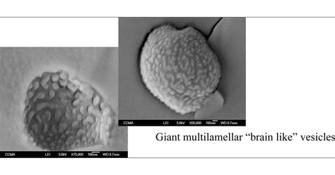 Giant Brainlike Aggregates from New 